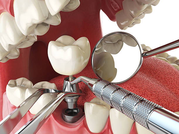Best Emergency Dental Surgery in Mineville, NY